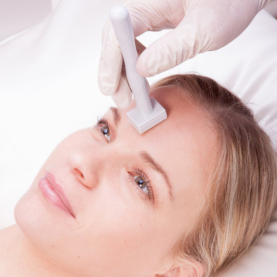 What is Derma Stamping?