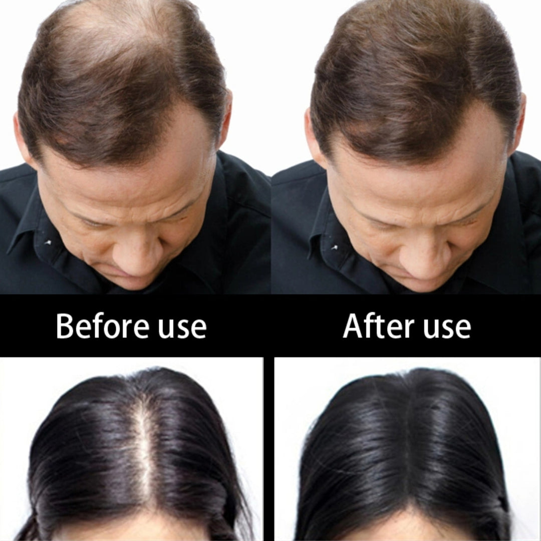 Hairline optimizer