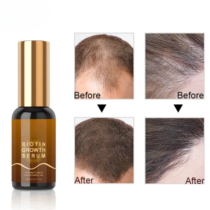 Biotin oil 30ml