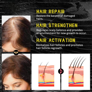 Essence for Hair Loss Dry Damaged Hair 50ml
