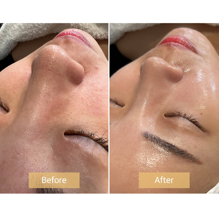 Before and after results using Stayve Salmon DNA Gold Ampoule showing improved skin texture and radiance