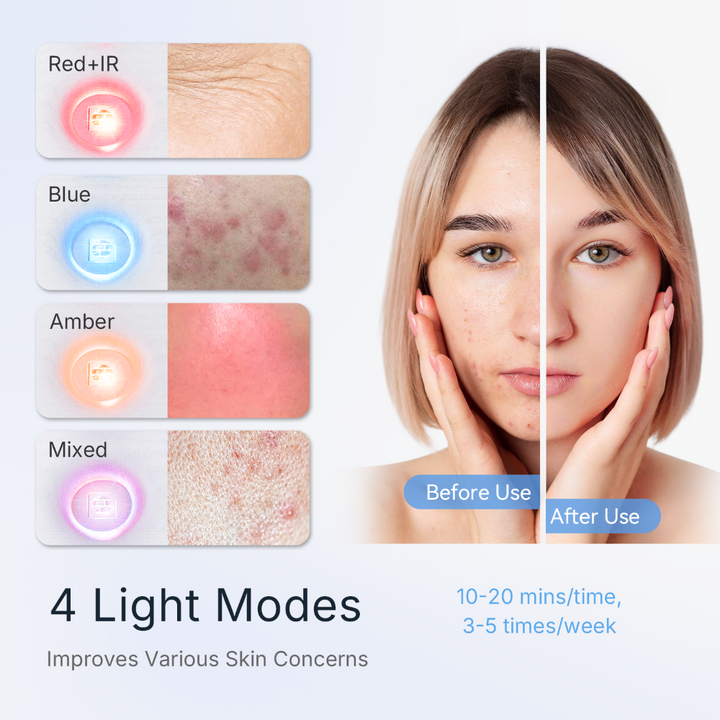 Goomi PDT LED Light Therapy Pod's four light modes, Red+IR, Blue, Amber and Mixed, shown with a before and after skin comparison