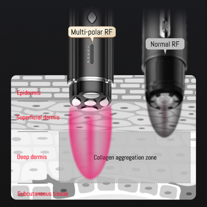 PRO Facial RF Skin Tightening Wand multipular illustration