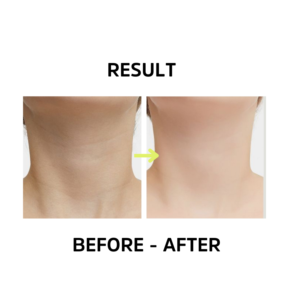 image of a woman's neck after and before using femvy 3 in 1 neck sculpting tool